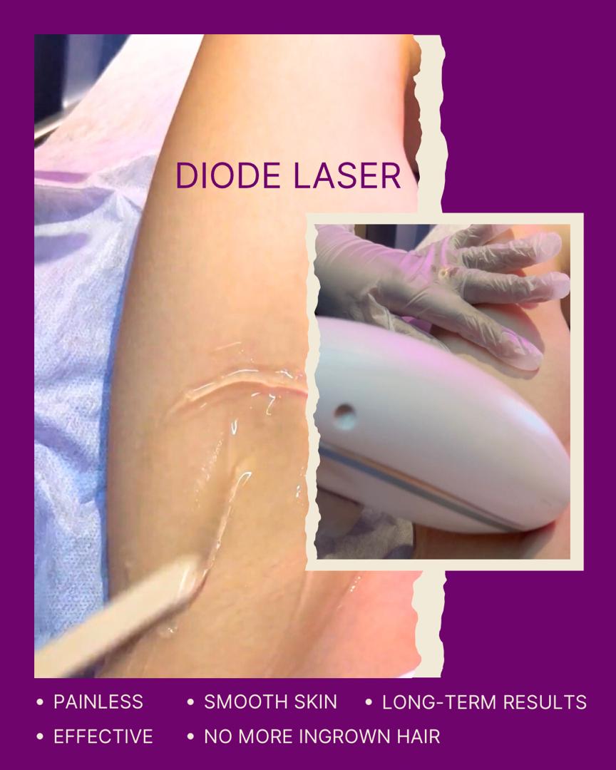 First Timer Laser Package: Diode Laser Totally Furless + Sisintime Baby V Serum — RM305 (UP RM438)